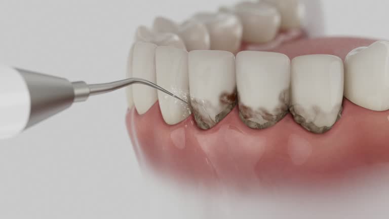 Trusted Teeth Cleaning And Checkup service in Santa Teresa, NM - Dentist Open Now